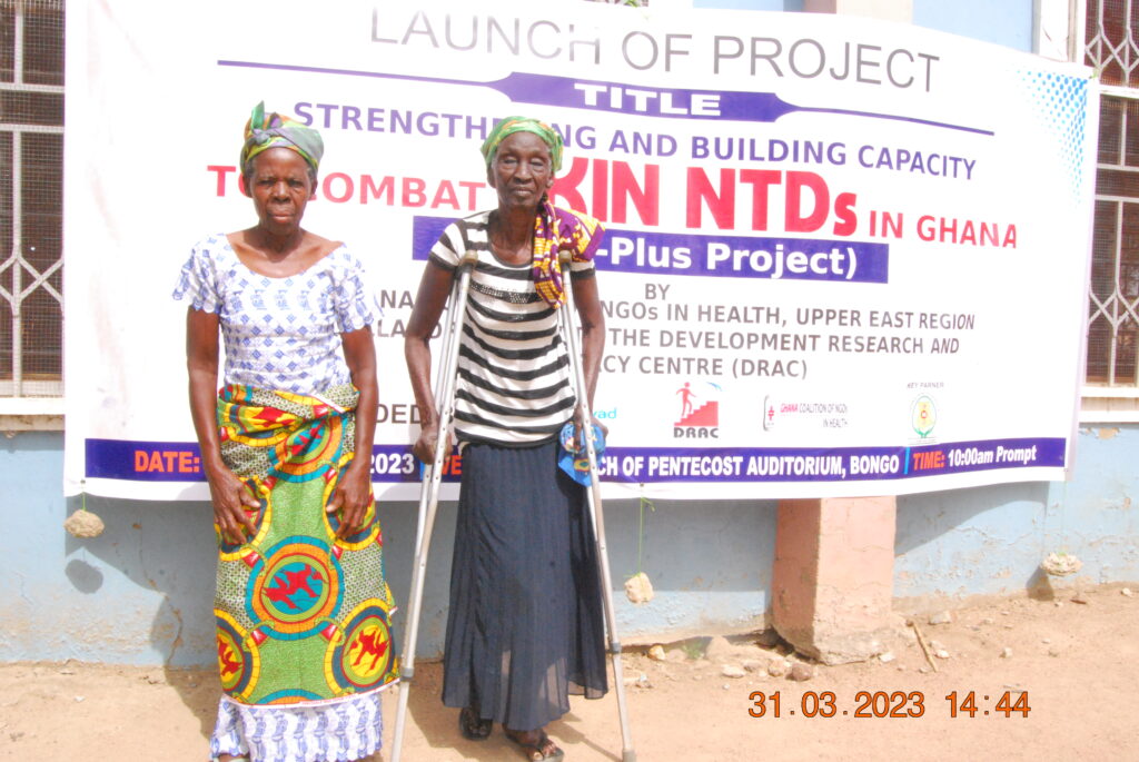 Supporting the Ghanaian Upper East Region to end NTDs